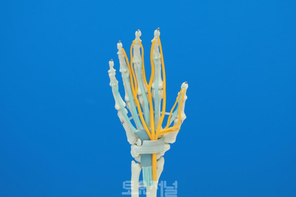 손목터널 증후[사진] 손 신경 모형.JPG